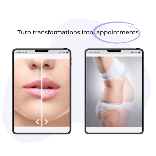 transformations into appointments