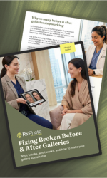 CT-202601-RxP-A Practical Guide to Fixing Broken Before & After Galleries-RC